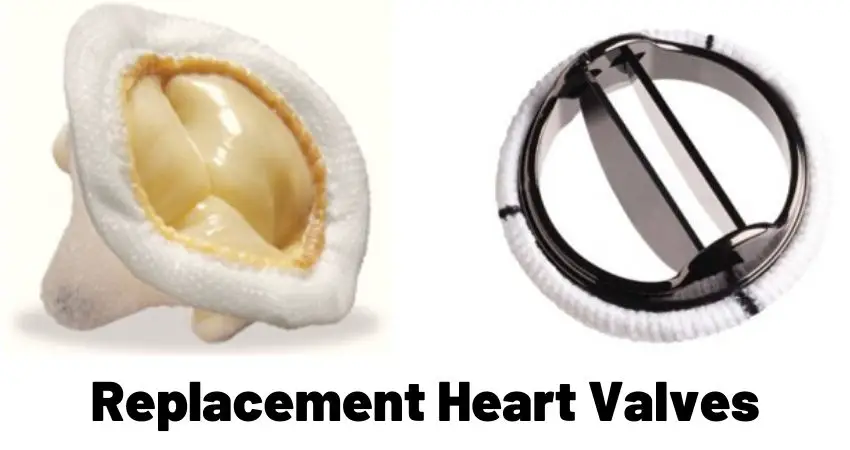 replacement heart valves